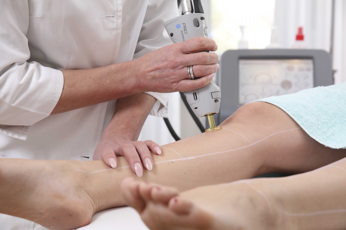Laserbehandlung an einer Beinpartie mit dem GentleMax Pro
